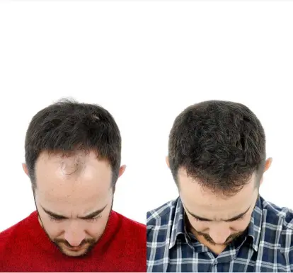 Scientific understanding of healthy hair growth and biology