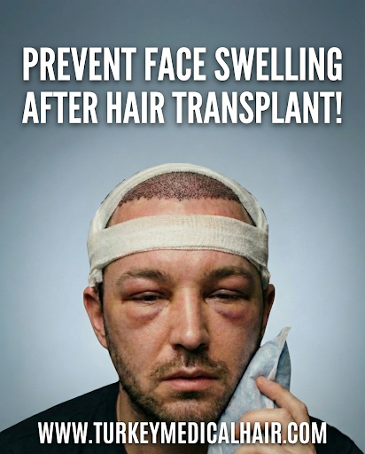 Face Swelling Prevention